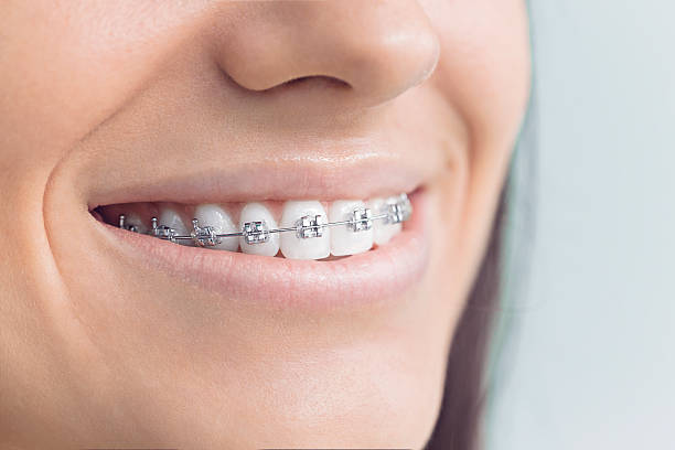 Best Veneers and Lumineers  in Wagon Wheel, AZ